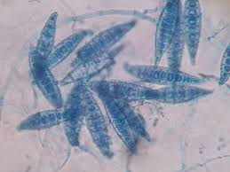 HONGOS ONICOMICOSIS FARMACIA ALBALÁ Microsporum