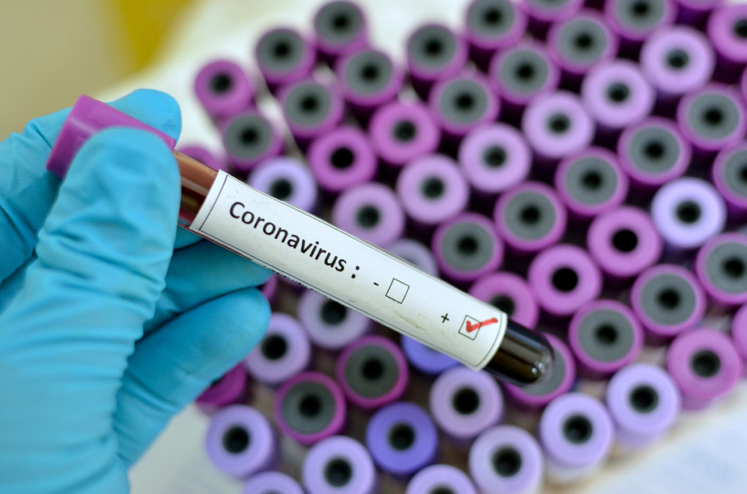 Test coronavirus