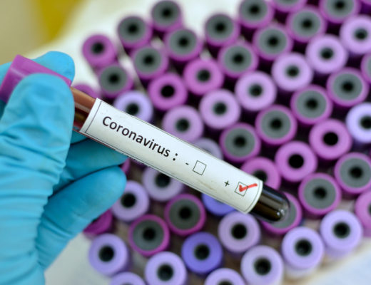 Test coronavirus